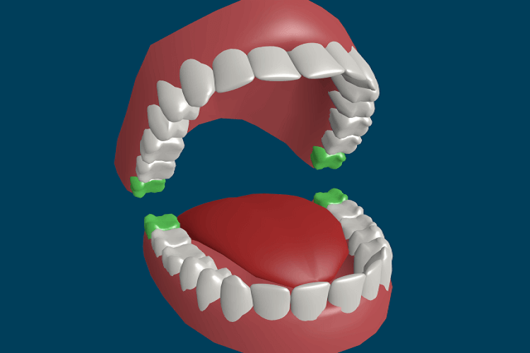 Эта стоматологическая процедура может привести к Раку2