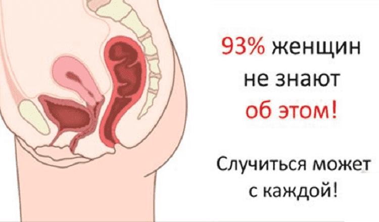 93% женщин оказались не в курсе! А ведь момент истины настанет для всех.