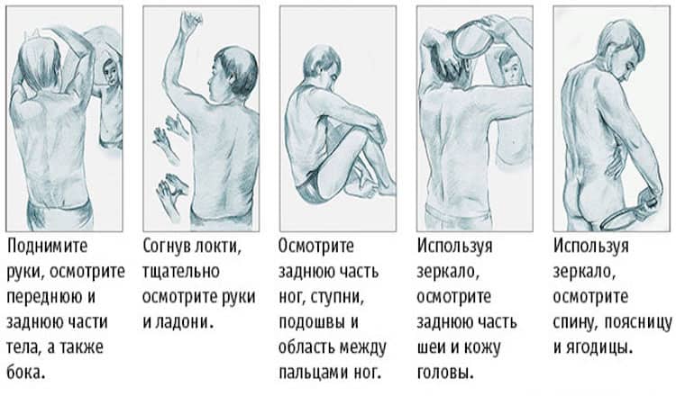 5 самых распространенных видов рака и их симптомы. Это важно знать