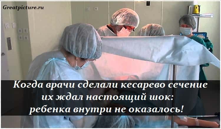 Когда врачи сделали кесарево сечение, их ждал настоящий шок: ребенка внутри не оказалось!