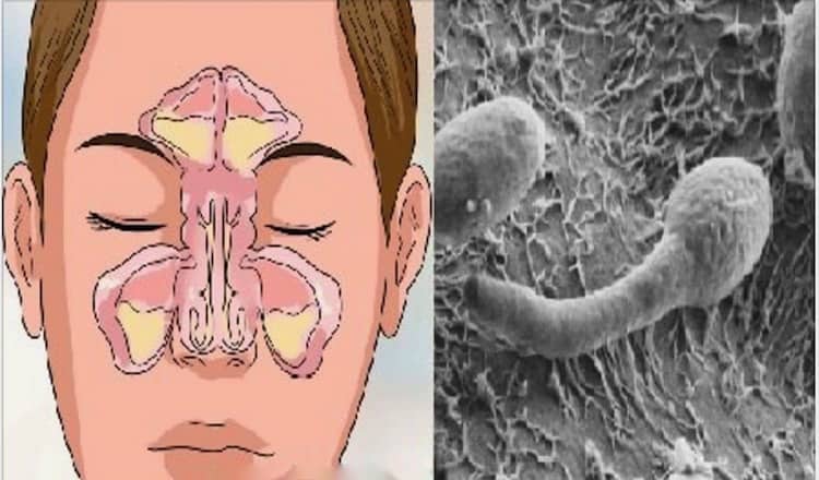 Проблема заложенности вашего носа в вашем кишечнике