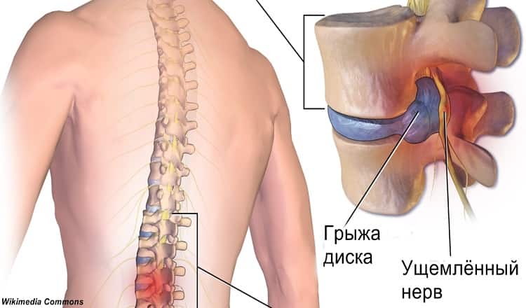 Хирург отговорил меня от операции и посоветовал делать эту зарядку! И ведь помогло!