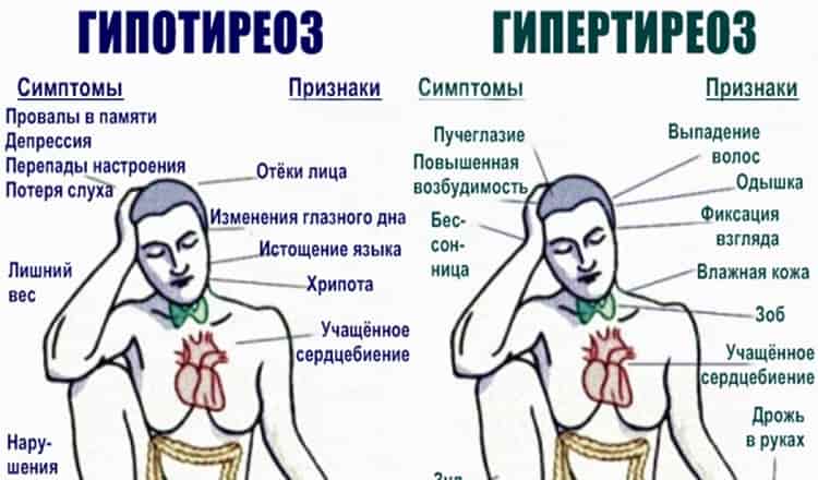 93% людей с проблемами со щитовидкой не знают об этом! Вот вся нужная информация!