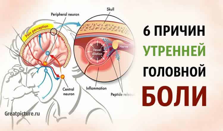 6 причин Утренней Головной Боли. А вы это знали?