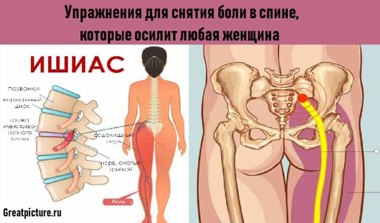 Упражнения для снятия боли в спине, которые осилит любая женщина