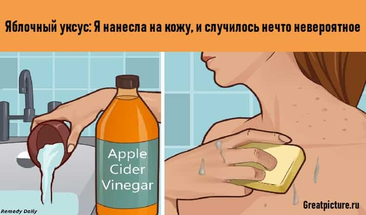 Яблочный уксус: Я нанесла на кожу, и случилось нечто невероятное