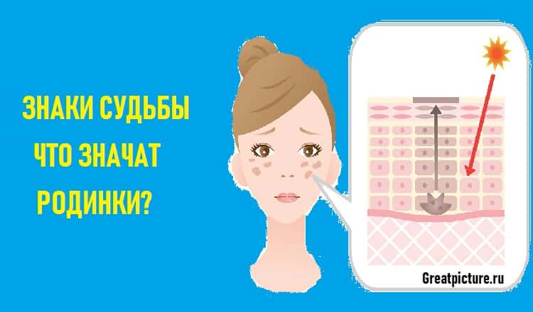 ЗНАКИ СУДЬБЫ. ЧТО ЗНАЧАТ РОДИНКИ?