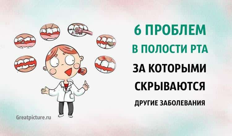 6 проблем в полости рта, за которыми скрываются другие заболевания