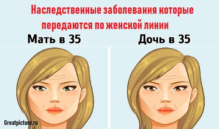 Наследственные заболевания которые передаются по женской линии