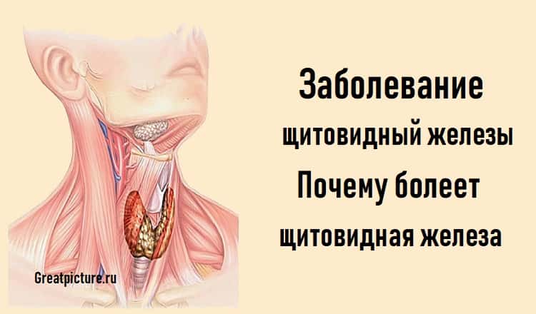 Заболевание щитовидный железы.Почему болеет щитовидная железа