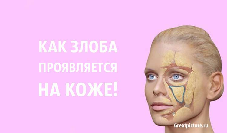 Как ЗЛОБА проявляется на коже. Последствия злобы ужасающи!