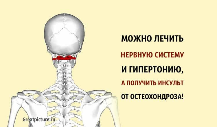 Можно лечить нервную систему и гипертонию, а получить инсульт!