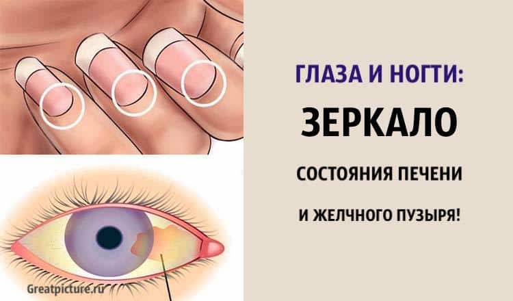 Глаза и ногти: зеркало состояния печени и желчного пузыря