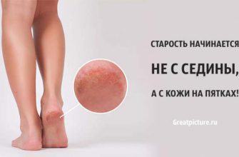 Старость начинается не с седины, а с кожи на пятках. Полезно знать!