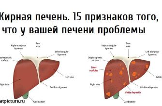 Жирная печень.15 признаков того, что у вашей печени проблемы