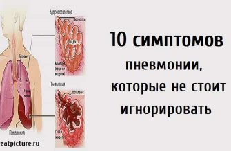 10 симптомов пневмонии, которые не стоит игнорировать