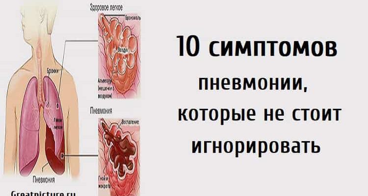 10 симптомов пневмонии, которые не стоит игнорировать