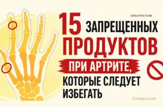 12 запрещенных продуктов при артрите