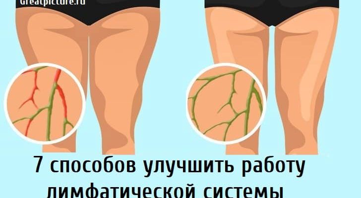 7 способов улучшить работу лимфатической системы