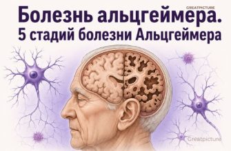 болезнь альцгеймера