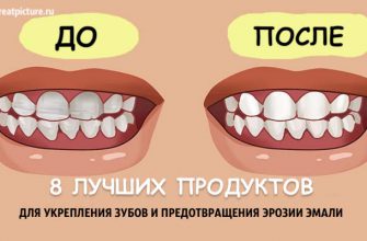 8 лучших продуктов для укрепления зубов и предотвращения эрозии эмали