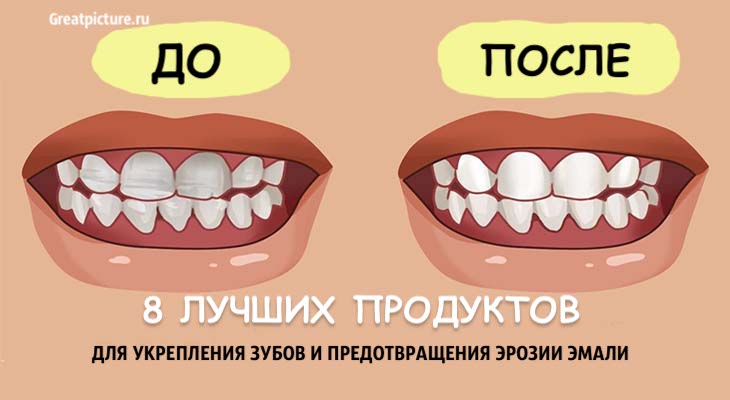 8 лучших продуктов для укрепления зубов и предотвращения эрозии эмали