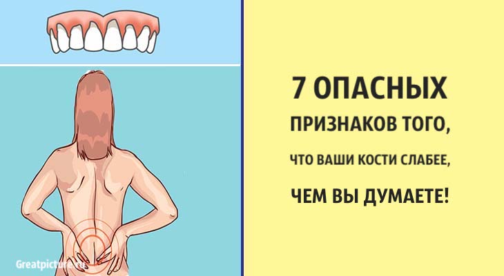 7 опасных признаков того, что ваши кости слабее, чем вы думаете!