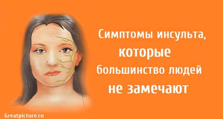 Симптомы инсульта, которые большинство людей не замечают