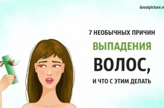 7 необычных причин выпадения волос, и что с этим делать