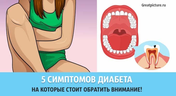 5 симптомов диабета на которые стоит обратить внимание!