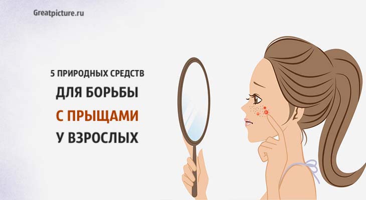 5 природных средств для борьбы с прыщами у взрослых