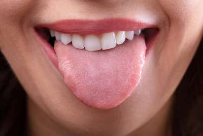 следы зубов на языке