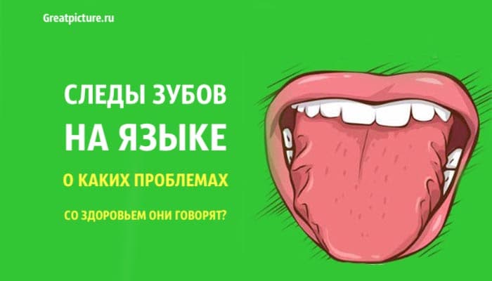 Следы зубов на языке1